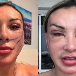 Andressa Urach pede socorro público: o que ela está tentando dizer