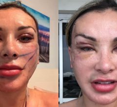 Andressa Urach pede socorro público: o que ela está tentando dizer