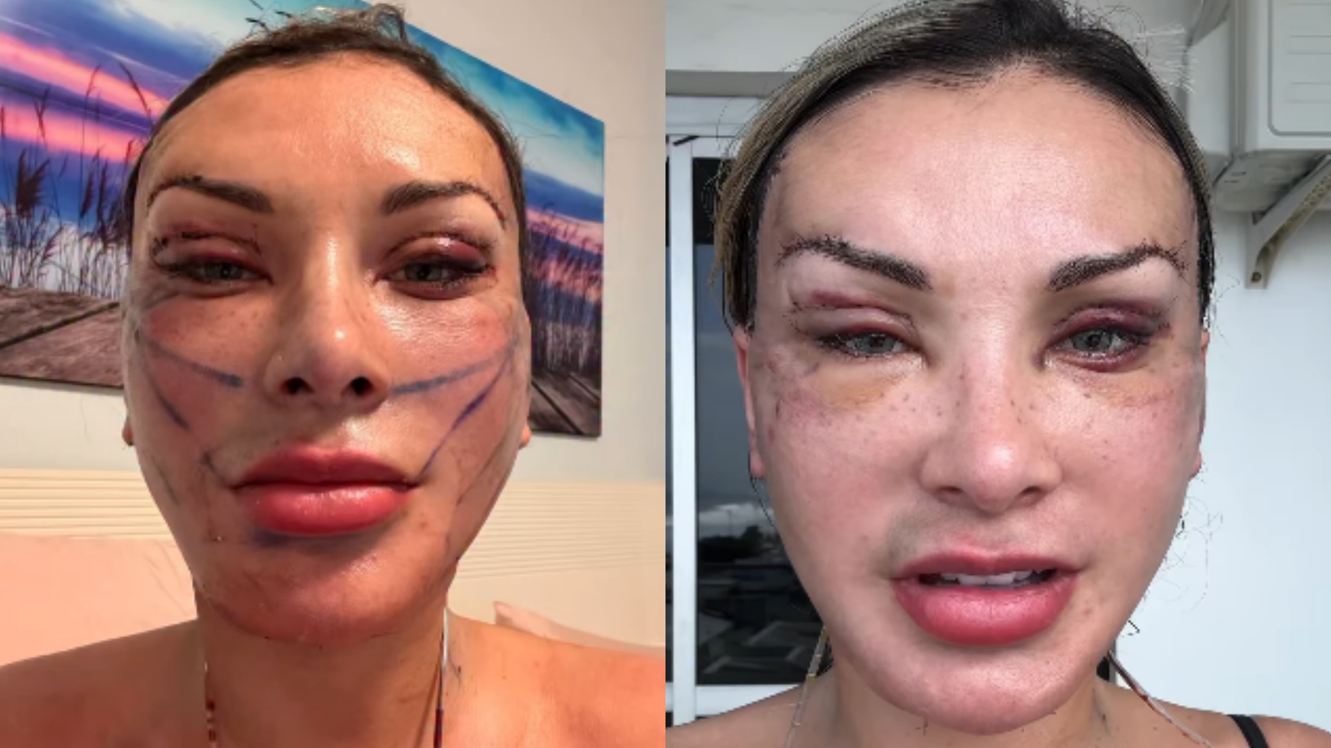 Andressa Urach pede socorro público: o que ela está tentando dizer