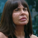 Gretchen confessa o que ninguém fala: a cirurgia após emagrecer
