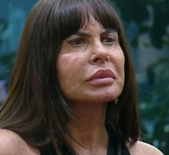 Gretchen confessa o que ninguém fala: a cirurgia após emagrecer