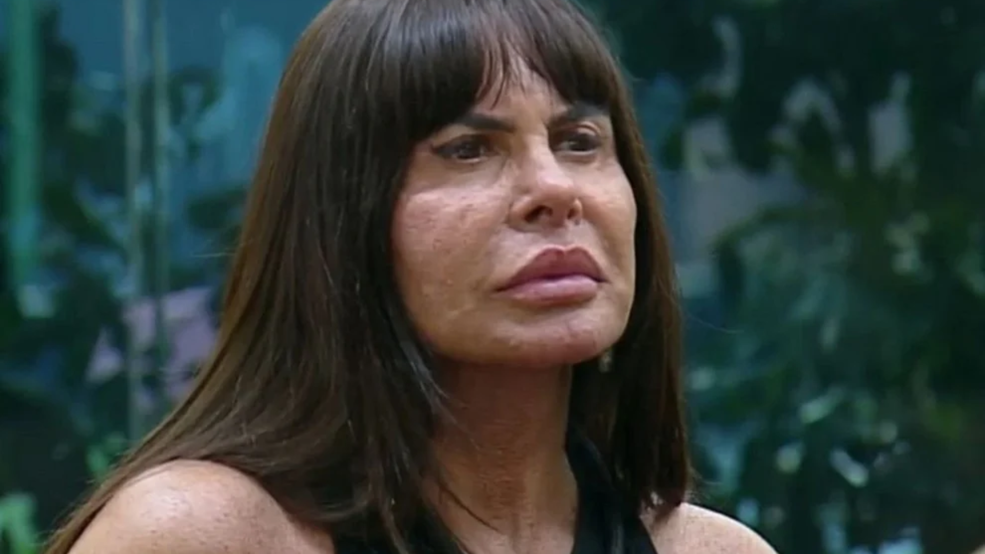 Gretchen confessa o que ninguém fala: a cirurgia após emagrecer