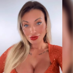 Andressa Urach e os 50 procedimentos: o rosto que nunca para