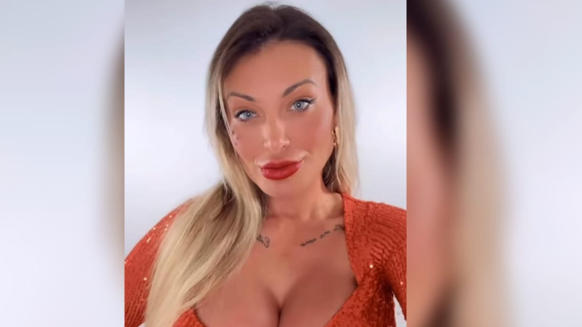Andressa Urach e os 50 procedimentos: o rosto que nunca para