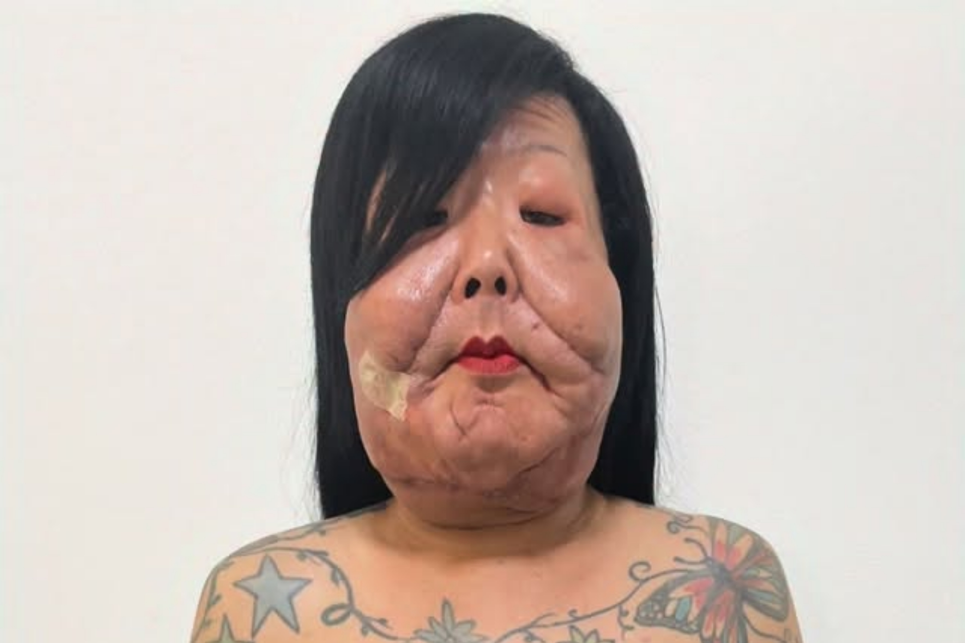 Juju do Pix mostra rosto após terceira cirurgia para retirar óleo mineral