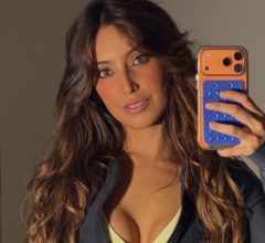 Vanessa Lopes mostra harmonização no bumbum e explica tudo