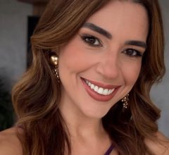 Vivian Amorim mostra antes e depois da harmonização facial após emagrecer