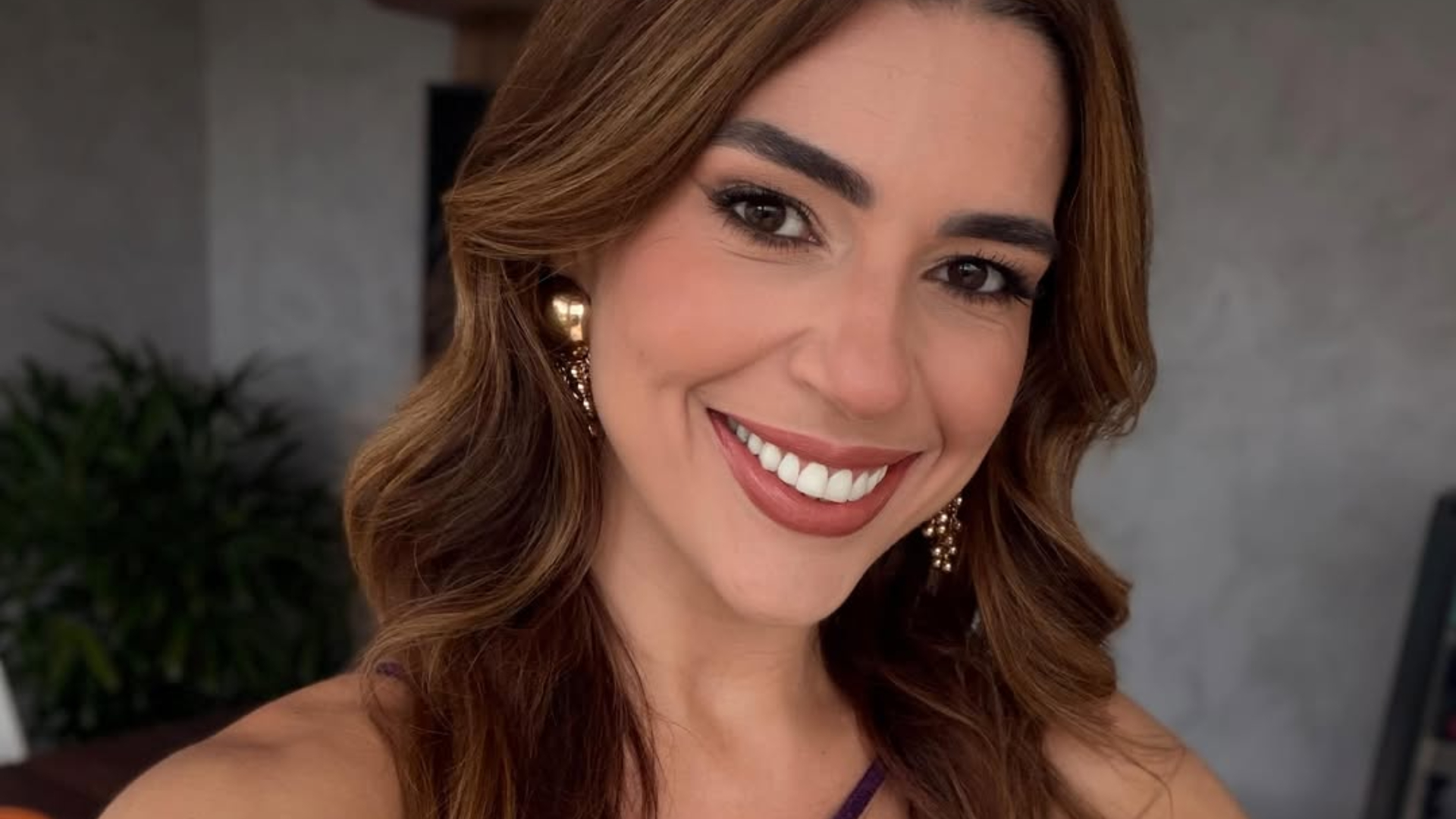 Vivian Amorim mostra antes e depois da harmonização facial após emagrecer