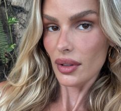 Yasmin Brunet e o diagnóstico que veio da rua