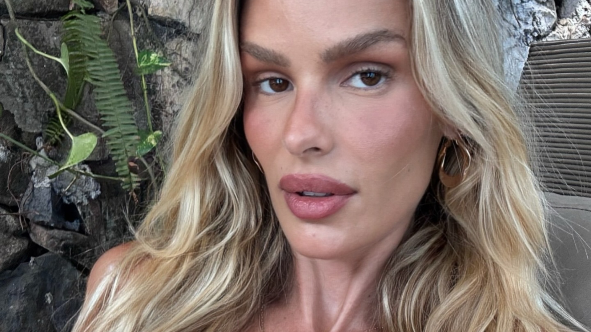 Yasmin Brunet e o diagnóstico que veio da rua