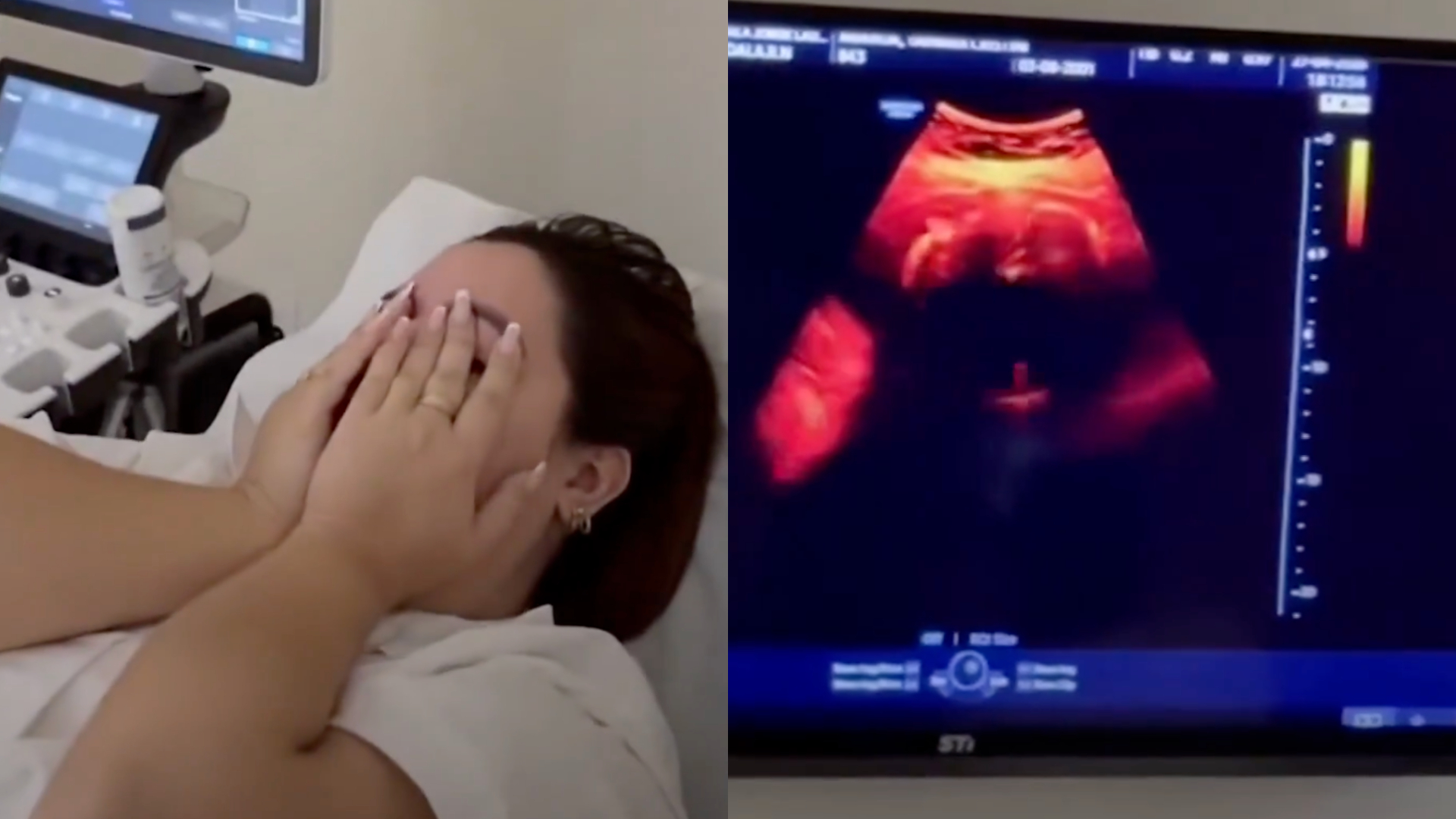 Mulher descobre gravidez aos 8 meses: "Achei que era gás"