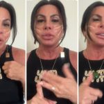 Gretchen remove PMMA dos lábios e explica por que cancelou o lifting facial