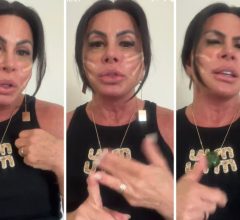 Gretchen remove PMMA dos lábios e explica por que cancelou o lifting facial