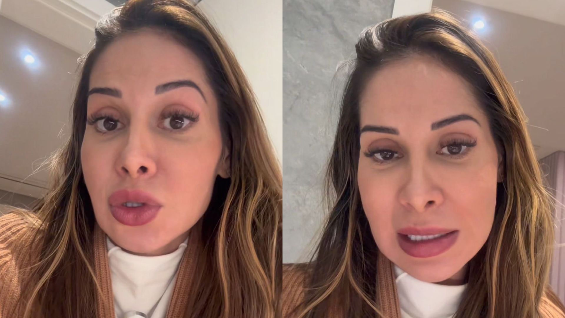 Maíra Cardi expõe sequela de PMMA no rosto e descarta cirurgia: "É para vocês acordarem"