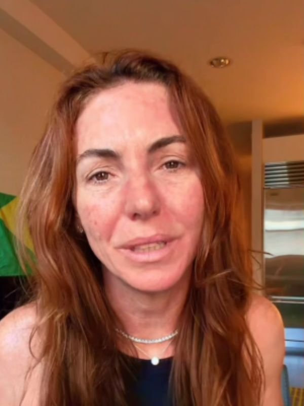 Glenda Kozlowski internada após cair em casa: "Muita dor"
