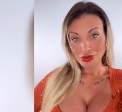 Andressa Urach revela antes e depois de Deep Plane e Fox Eyes