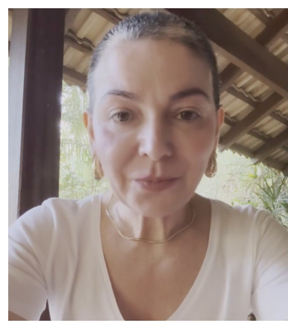 Mãe de Lucas Lucco revela volta da alopecia: “Vou seguir firme”