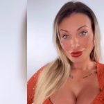 Andressa Urach revela antes e depois de Deep Plane e Fox Eyes