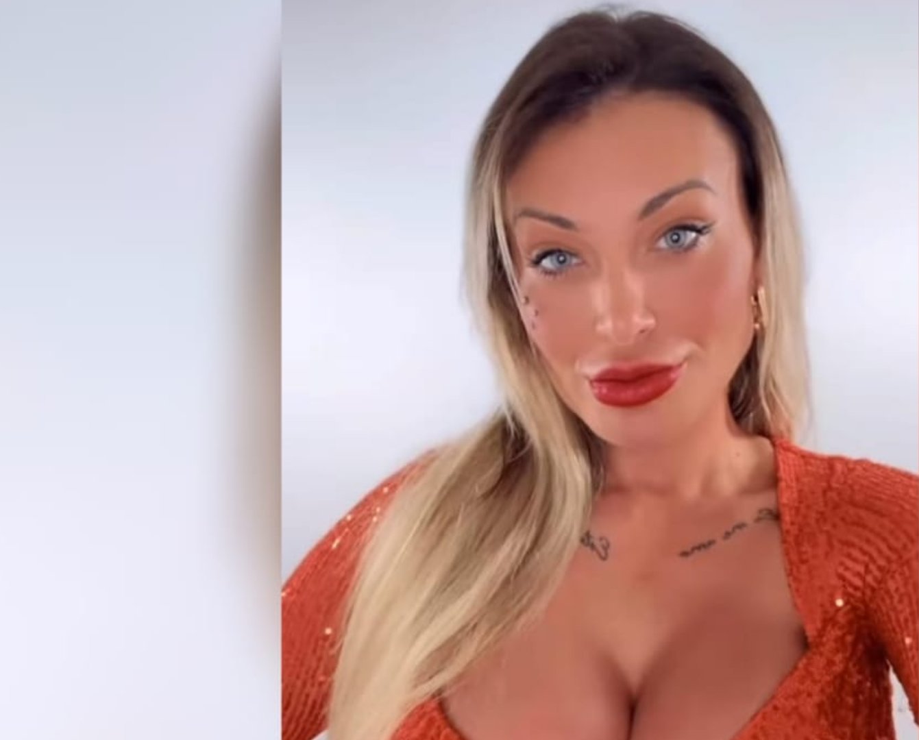 Andressa Urach revela antes e depois de Deep Plane e Fox Eyes