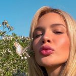 Karoline Lima entrega: "Já era para ter saído" o preenchimento labial