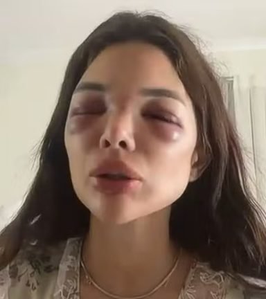 Câmeras mostram seguranças ajudando empresário a levar Giullia Falcão para dentro de casa durante agressão