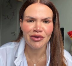 Thaís Carla assume uso de caneta emagrecedora após perder mais de 100 kg