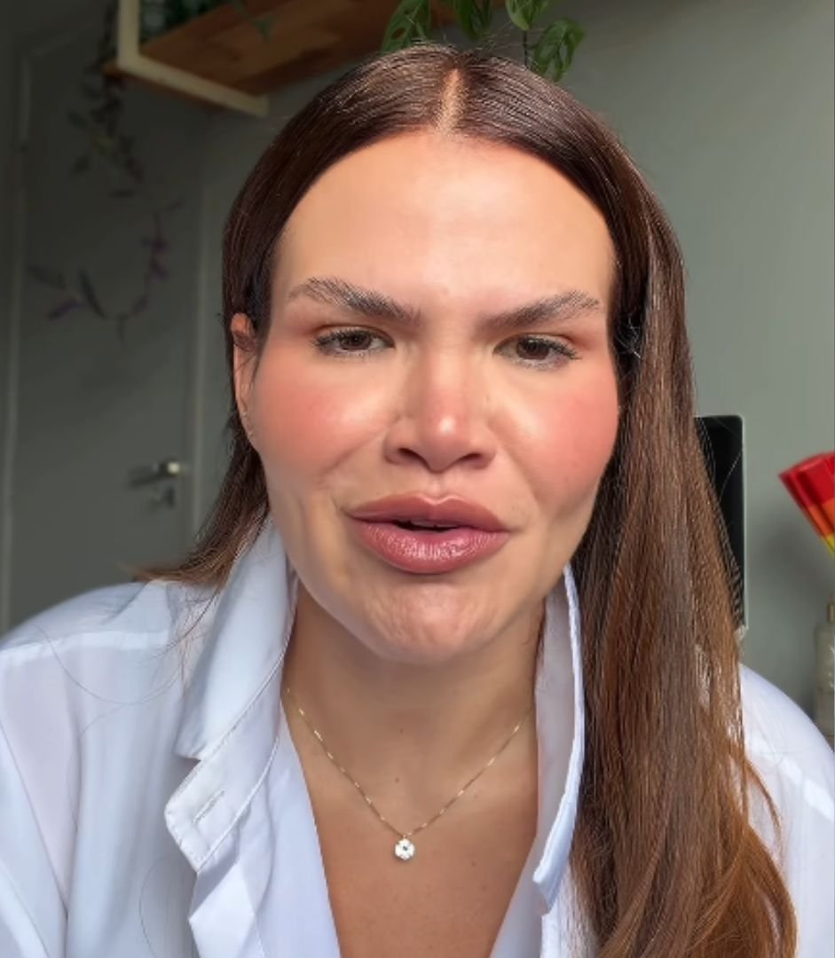 Thaís Carla assume uso de caneta emagrecedora após perder mais de 100 kg