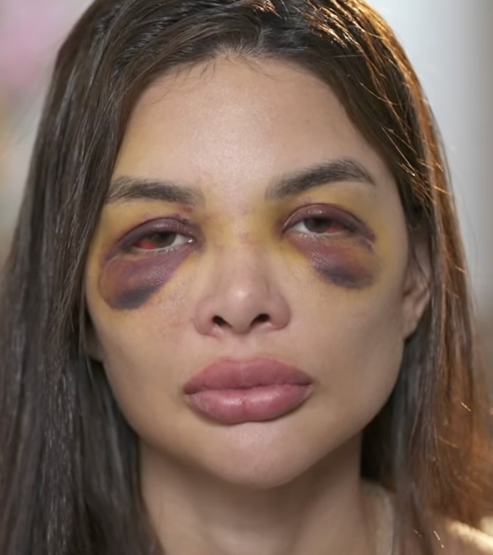 Giullia Falcão relata violência sexual no "Fantástico": "Eu acordava com ele em cima de mim"