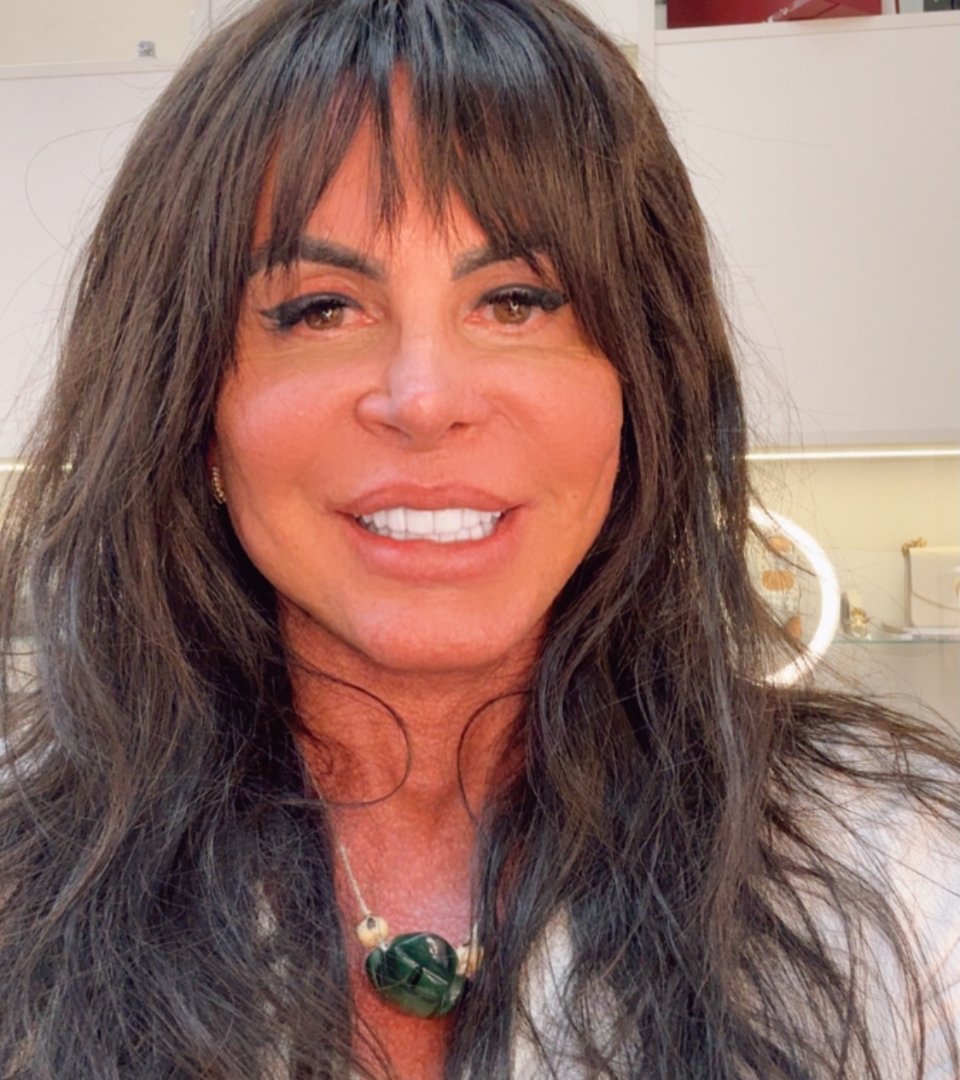 Gretchen raspa a cabeça ao vivo antes do transplante capilar e detona críticos