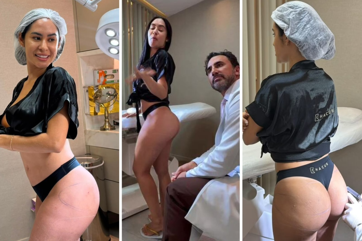 Isabelle Nogueira faz harmonização de glúteos e revela o motivo real