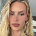 Yasmin Brunet expõe pernas cheias de roxos e entrega o motivo