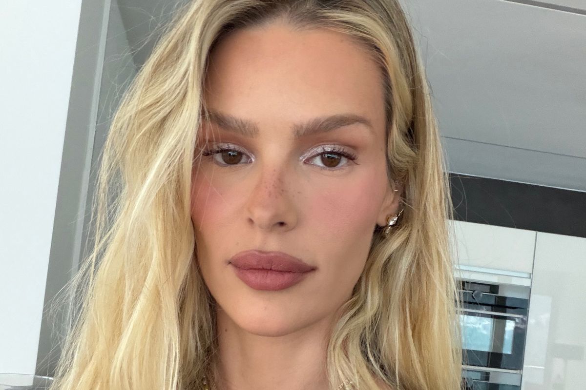 Yasmin Brunet expõe pernas cheias de roxos e entrega o motivo