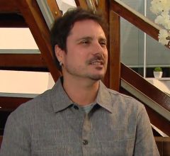 Sergio Abreu faz harmonização facial aos 51 e revela resultado ao vivo no SBT