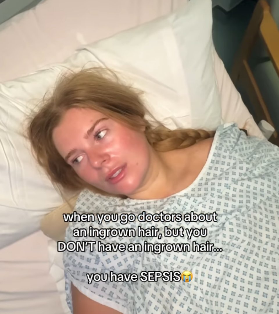 Influenciadora britânica quase morre após espremer pelo encravado na virilha